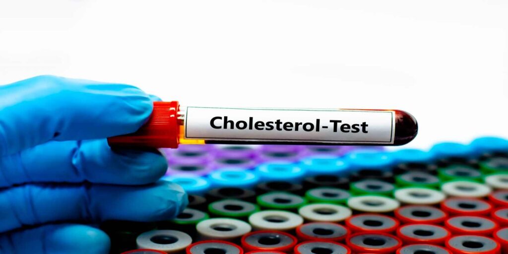 Cholesterol Testing Guidelines by Age and Risk Level