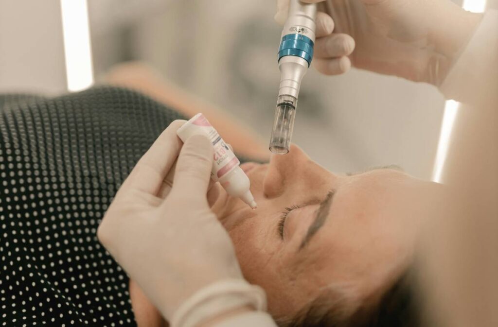 How Long Does Microneedling Last? – Beautiful With Brains