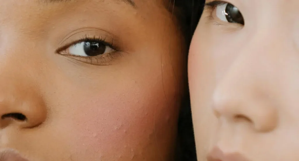 Everything You Need To Know – Beautiful With Brains