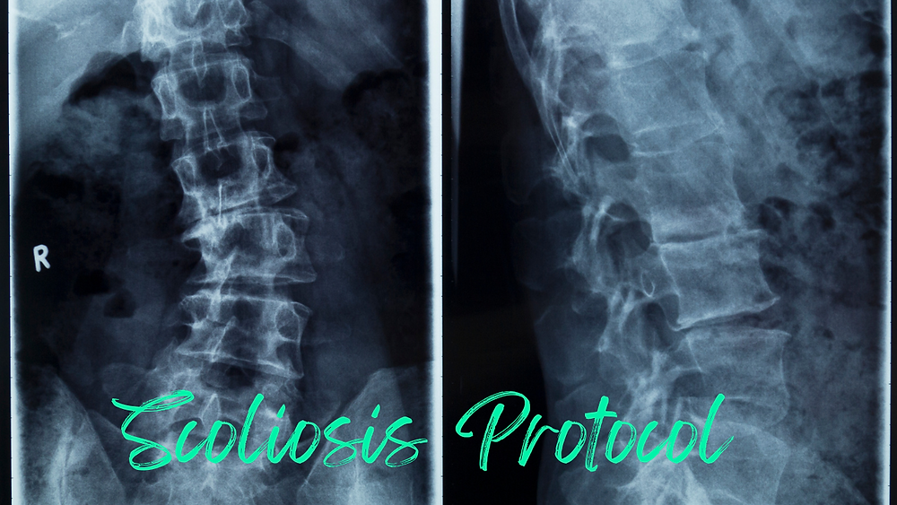 Herbal Protocol for Scoliosis