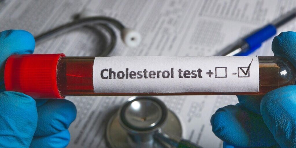 How Hormones and Aging Affect LDL Cholesterol in Women and Men