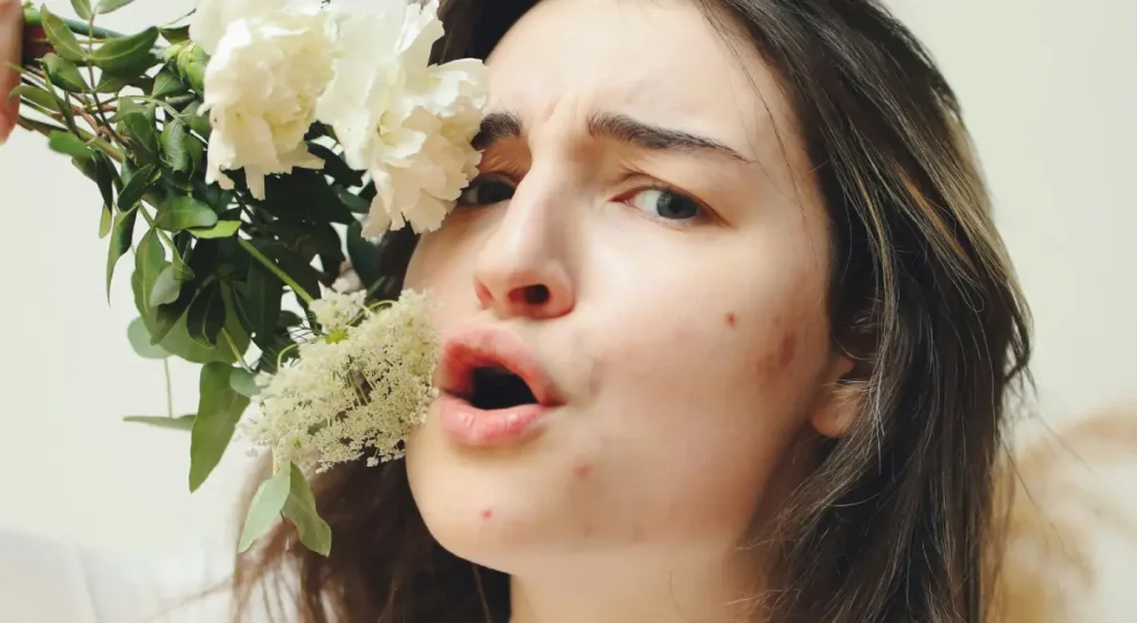 How To Cover Up A Pimple Scab (Without Making It Worse) – Beautiful With Brains