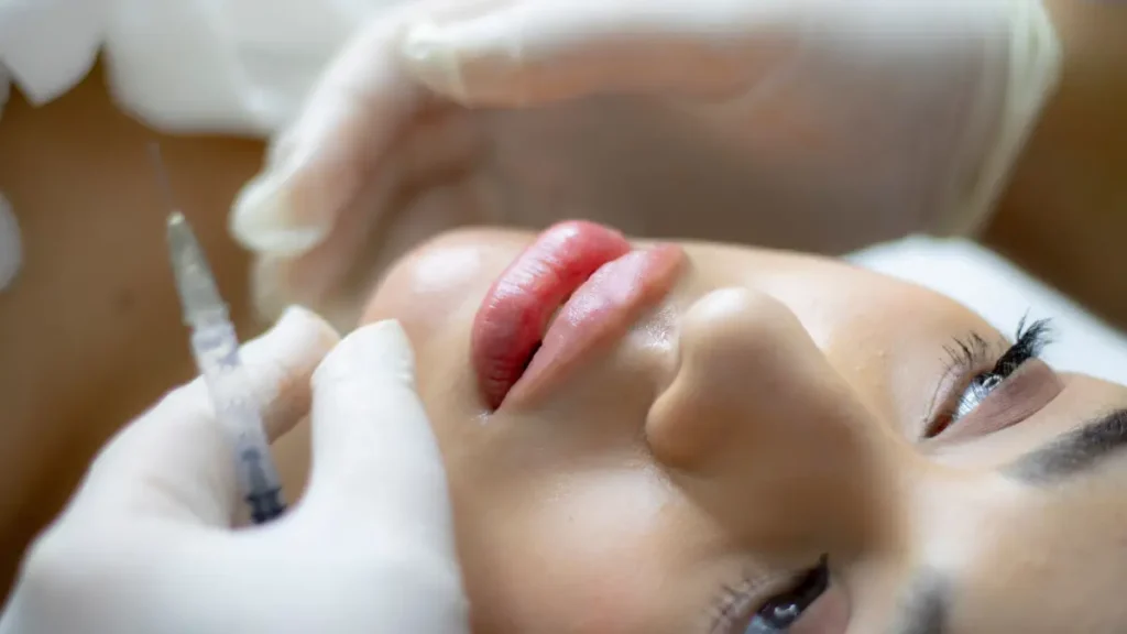 Can You Get Lip Fillers While Breastfeeding? – Beautiful With Brains