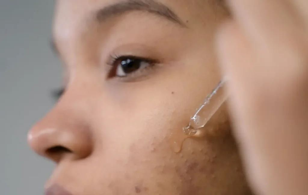 Which One Is Better For Dark Spots? – Beautiful With Brains